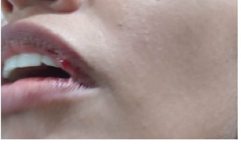 home page post