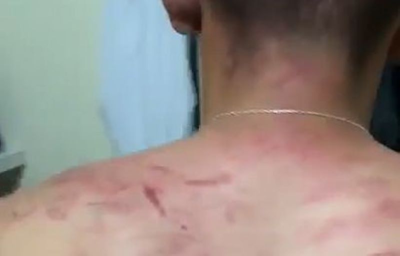 Funcionário da prefeitura de Atalaia denuncia que foi espancado por tentente da PM durante abordagem